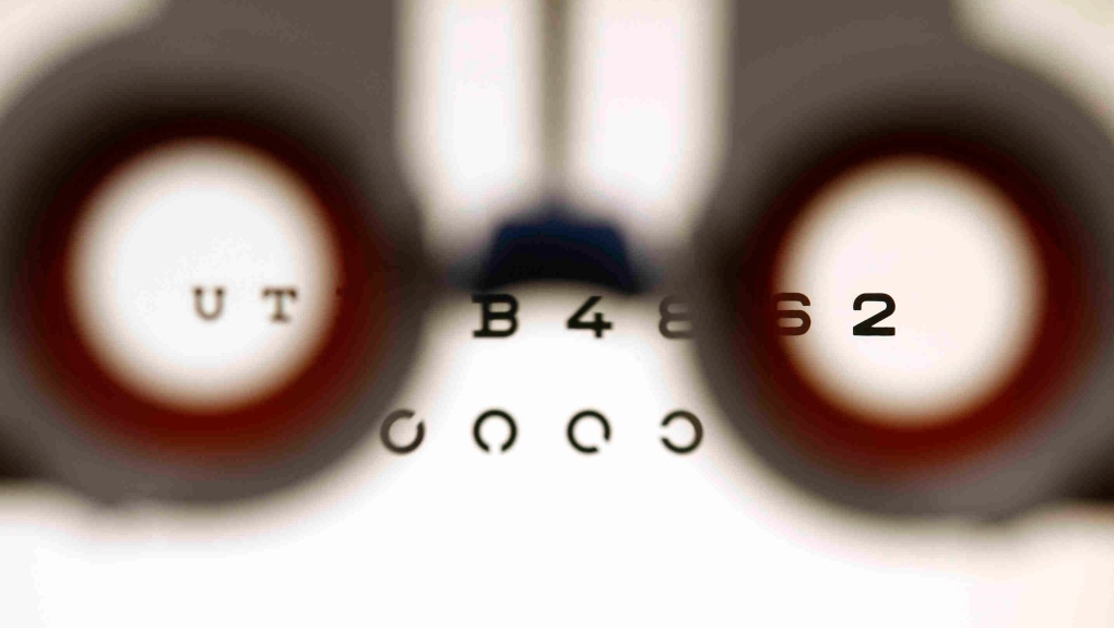 An optometrist holds glasses in front a lightbox during an eyesight test in Bremen, Germany, on Friday, Jan. 16, 2009. (THE CANADIAN PRESS/AP/Joerg Sarbach)