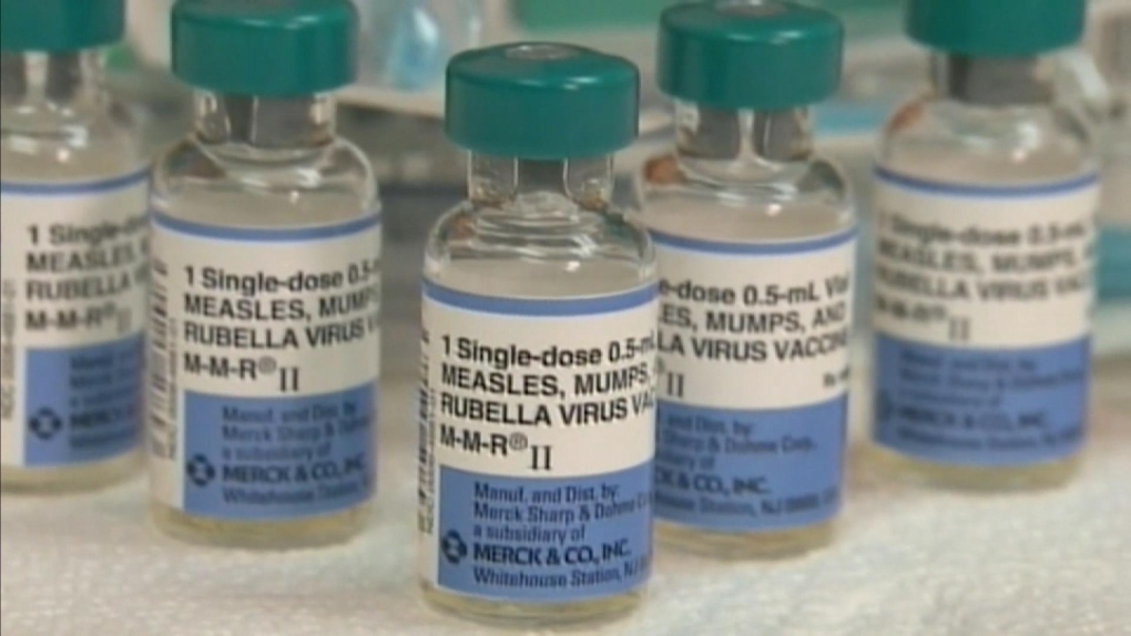 Ontario measles: Number of cases surpasses total for 2023